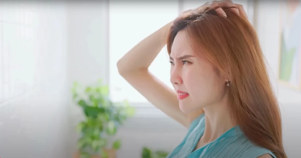 فروة رأس دهنية وكيفية التعامل معها